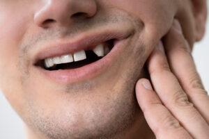 Close-up Of A Man Having Tooth Problem